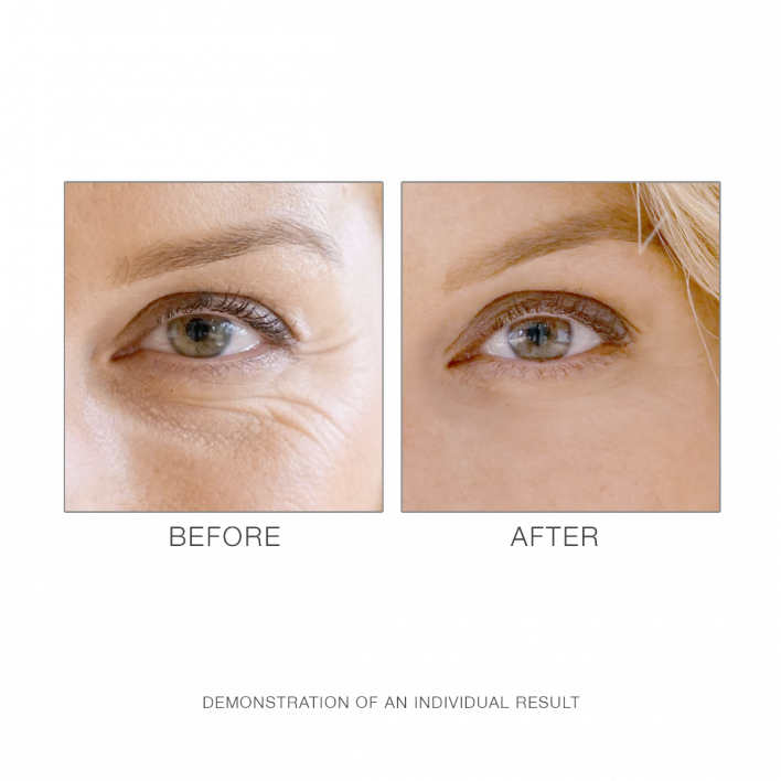Околоочен балсам M. Asam Retinol Intense Eye Balm 15ml — 2