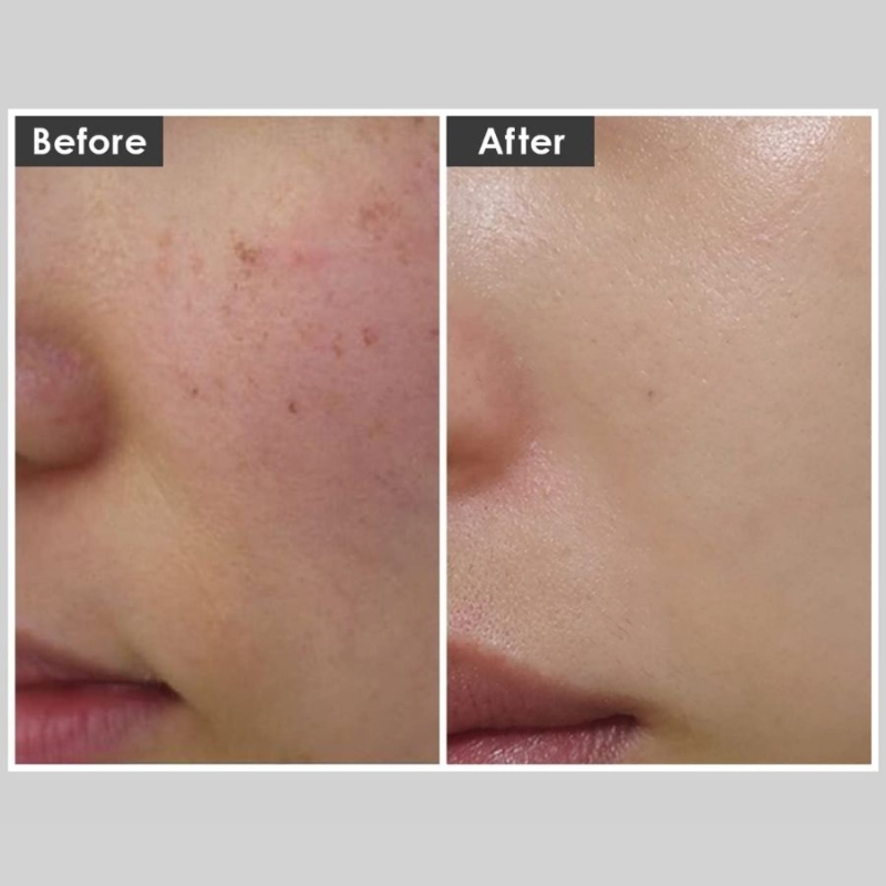 Гел за дълбоко почистване на кожата с детокс ефект Medi-Peel Algo-Tox Deep Clear 150ml — 3