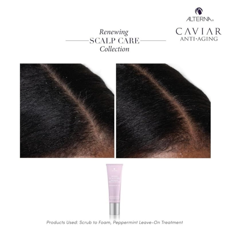 Ребалансираща терапия с мента за сух и проблемен скалп Alterna Renewing Scalp Care Peppermint Treatment 74 ml — 4