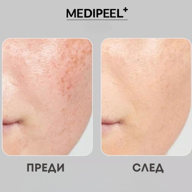 Озаряващ витаминен серум с 20% ниацинамид MEDI-PEEL Peptide 9 Vitanol Ampoule PRO 30 ml — 4