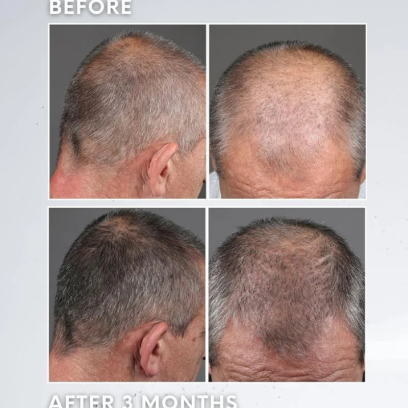 Лосион против побеляване или посивяване на косата Subrina Professional Care Scalp Anti-Greying Lotion 120 ml — 4