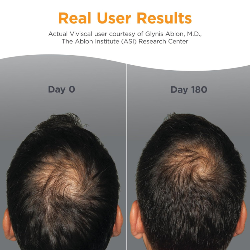 Хранителна добавка за растеж на коса при мъже Viviscal Men Hair Growth Supplements 60 таблетки — 3