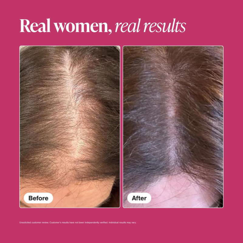 3-месечна програма против косопад и за растеж на косата Viviscal Hair Growth за жени — 2