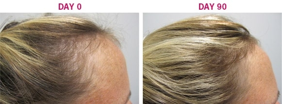 3-месечна програма против косопад и за растеж на косата Viviscal Hair Growth за жени — 3