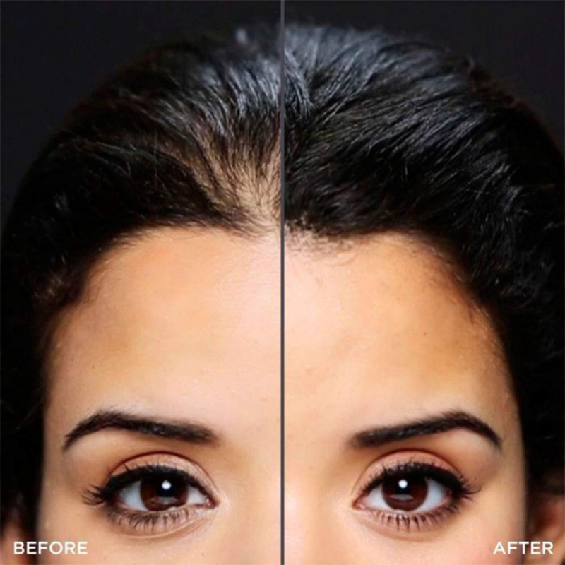 Шаблон за естествена предна линия на косата при нанасяне на фибри Тoppik Hair Optimizer — 2