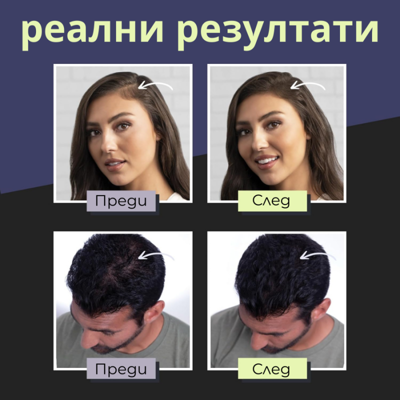 Кератинови фибри за моментално визуално сгъстяване на косата Toppik Hair Building Fibers 12 g — 12