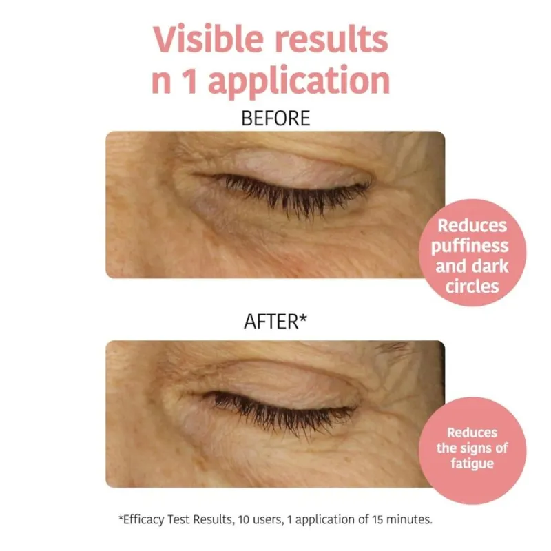 Пачове за очи срещу тъмни кръгове с Витамин С Iroha Anti-fatigue and Illuminating Eye Contour Patches with Vitamin C — 2