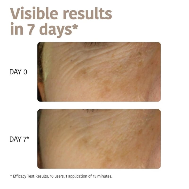 Iroha Wrinkle Filler & Anti-Age Face Mask with Triple Hyaluronic Acid — 5