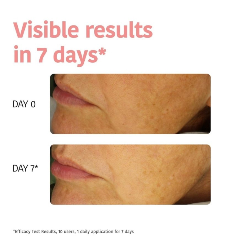 Антиоксидантна маска за лице с Витамин C Iroha Brightening Tissue Mask with Vitamin C + HA — 7