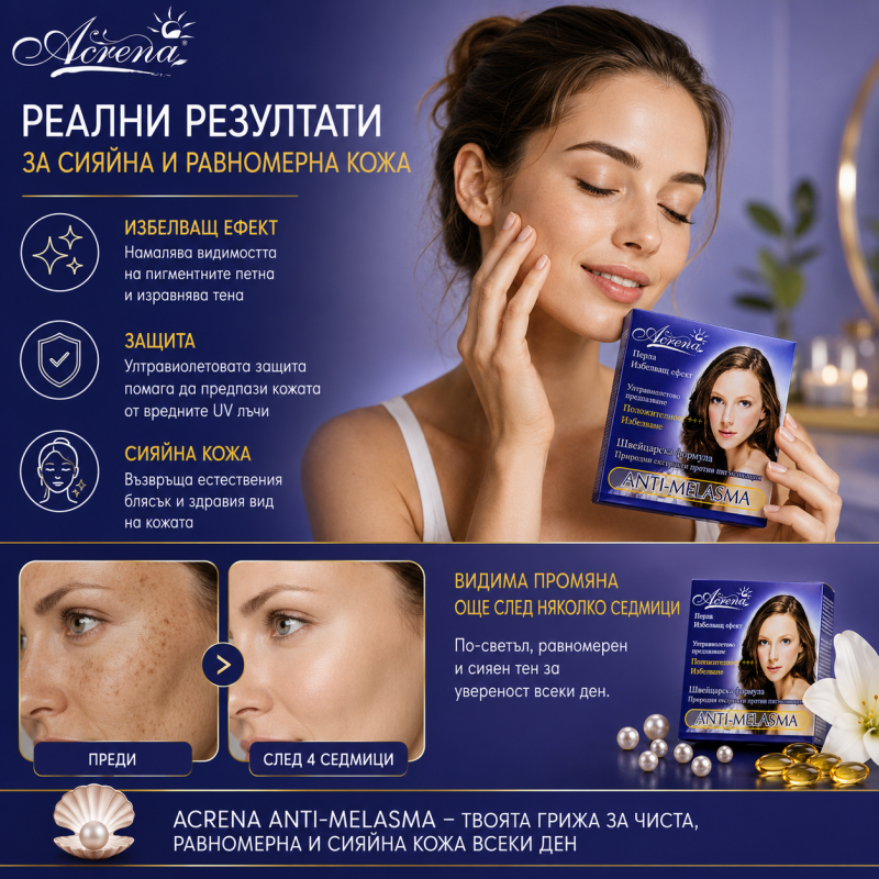 Acrena Anti-Melasma Whitening Cream 4ml — 5